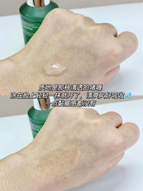 去黑头排行榜第一名！夏季控油祛痘必囤油皮推荐的十大品牌(图4)