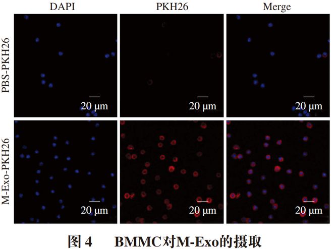 《食品科学》：南昌大学李欣教授等：基于肥大细胞脱颗粒模型研究牛乳外泌体的抗过敏活性(图3)