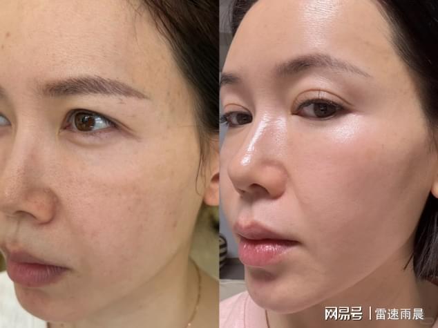 女士洗面奶品牌排行榜前十名？洗面奶什么牌子好用唯一正品种草(图4)