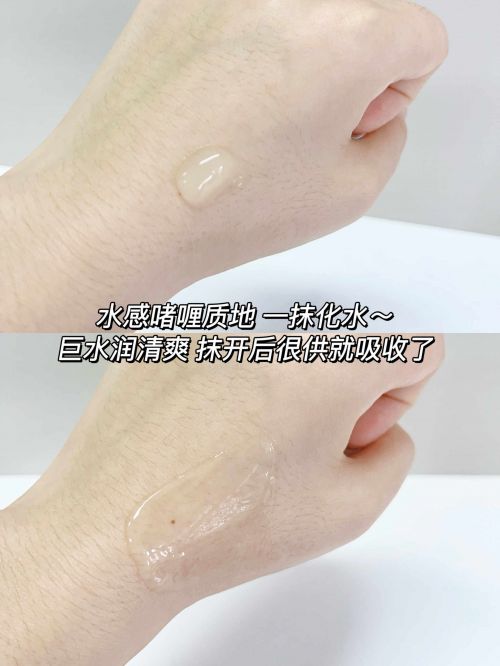 祛痘的品牌排行榜！2025祛痘产品实测这10款痘痘肌必看(图4)