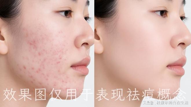 杜馥尔：被称为护肤品界“天然绷带”的TA真有那么神？(图1)