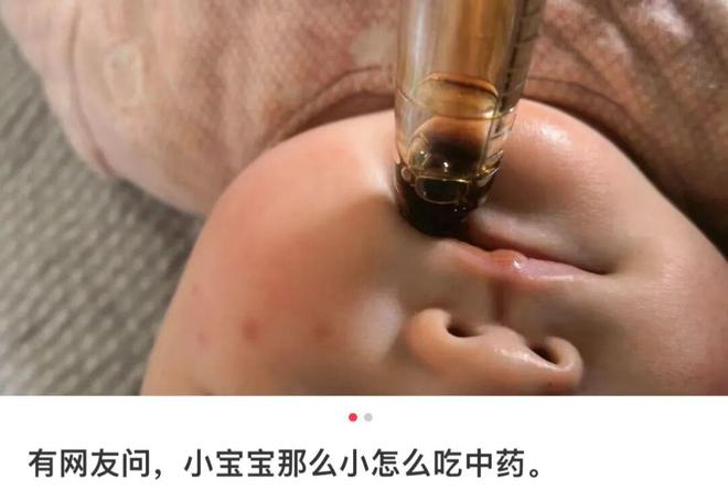 给孩子戴“舌套”喝灌中药？当心伤害远超你的认知！(图5)
