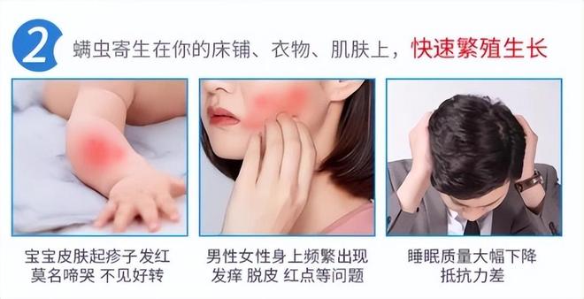 除螨喷雾能除螨吗？2026解析喷雾又好又实用TOP1效果强(图2)