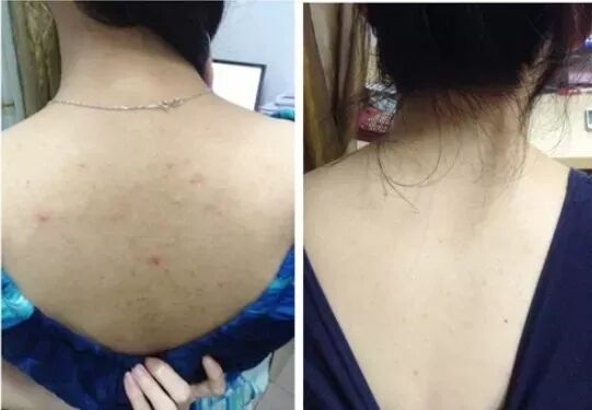 除螨喷雾是智商税吗？仙贝宁除螨率9999%实力派不踩雷(图8)