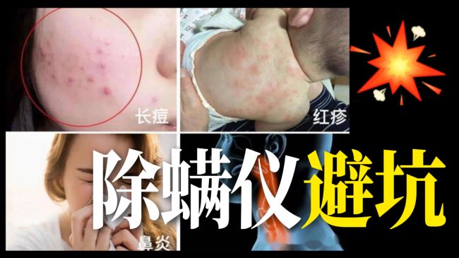 除螨仪器真的有效吗还是忽悠？全网畅销的品牌10大排行榜最新推荐