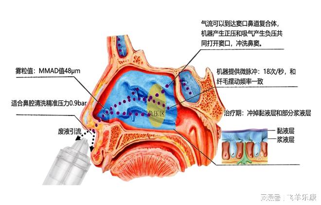 对宠物过敏鼻子遭殃？飞羊洗鼻器冲走过敏原还你畅快呼吸(图1)